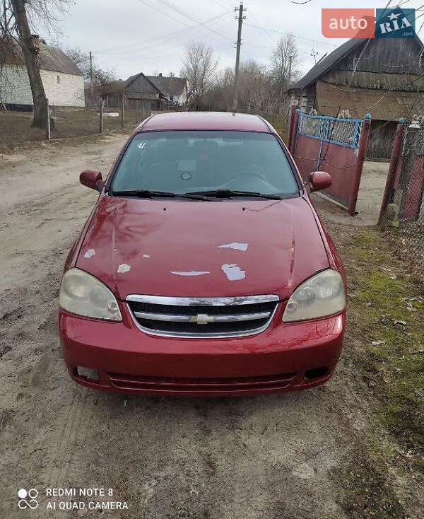 2008 chevrolet lacetti